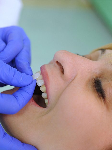 Woman getting a veneer.